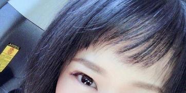 吃哈密瓜脸水肿,揭秘吃哈密瓜引发脸水肿的真相